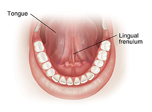 Front view of open mouth showing lingual frenulum underside of tongue.