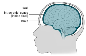 Inside the head, the brain sits inside the skull with a space between them called intracranial space.