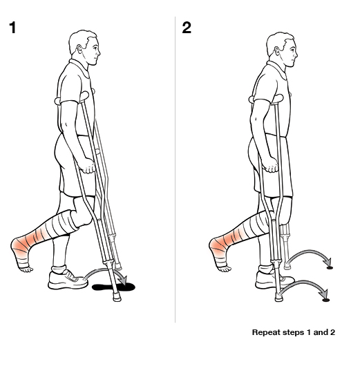 2 steps in using crutches with swing to (non-weight bearing).
