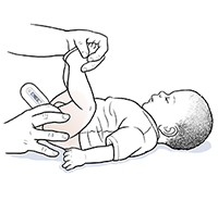 Baby on back with legs lifted, and parent inserting rectal thermometer into anal opening.