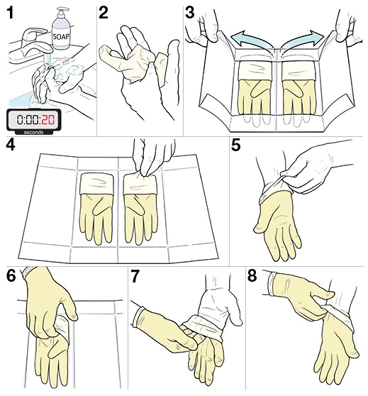 8 steps for putting on sterile gloves.