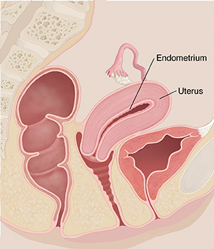 Side view cross section of woman's pelvis showing normal uterus and lining of uterus.