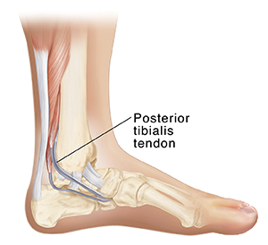 Side view of the foot and ankle, showing location of posterior tibialis tendon.