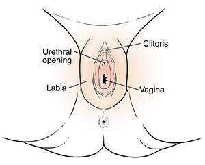 External genitals of female child, showing urethral opening inside the labia, between the clitoris and vagina.