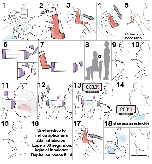 17 pasos para usar un inhalador de dosis medida con espaciador